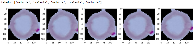 Sample augmented images Sample augmented images